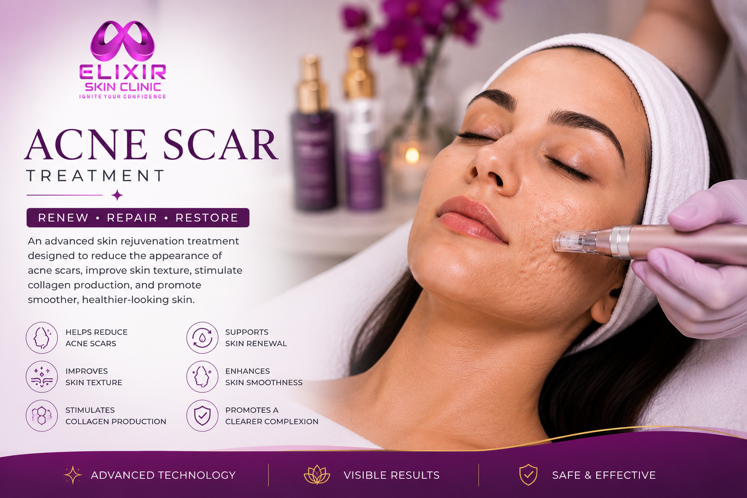 Acne Scar Treatment